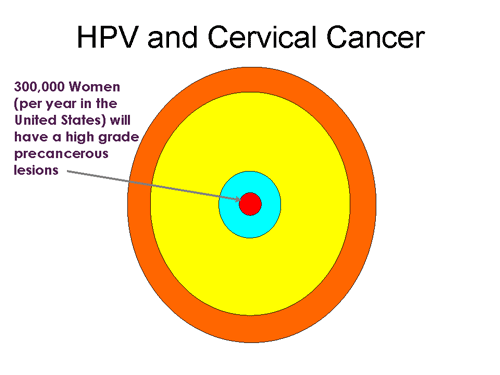 HPV and Cervical Cancer - 300,000 Women (per year in the Unites States) will have a high grade precancerous lesions.